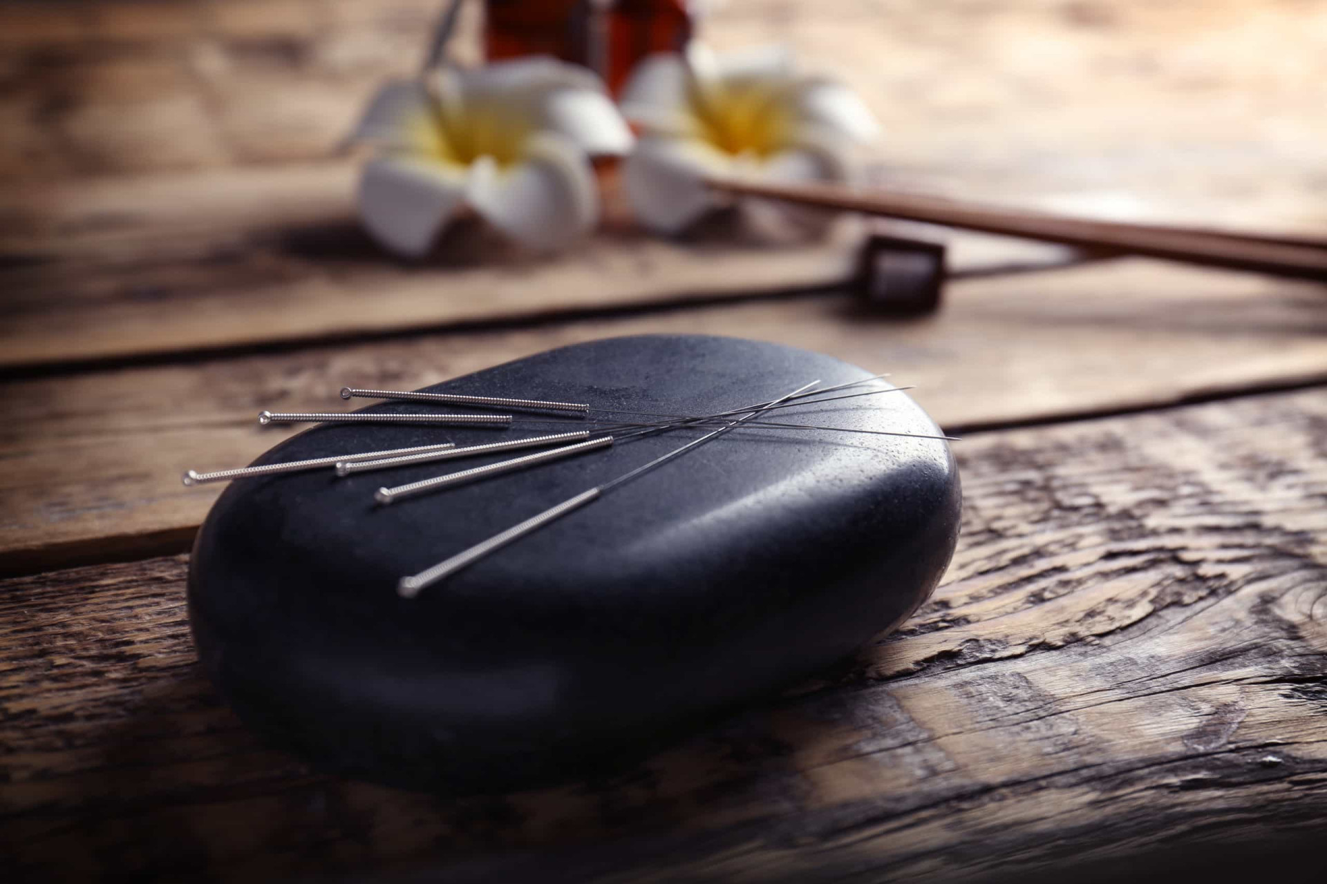 <p>Many people don't see acupuncture as a serious treatment, which is mainly due to misinformation. In fact, acupuncture needles are seen and treated as a medical device, and the acupuncturist has to have a proper license.</p><p><a href="https://www.msn.com/en-us/community/channel/vid-7xx8mnucu55yw63we9va2gwr7uihbxwc68fxqp25x6tg4ftibpra?cvid=94631541bc0f4f89bfd59158d696ad7e">Follow us and access great exclusive content every day</a></p>