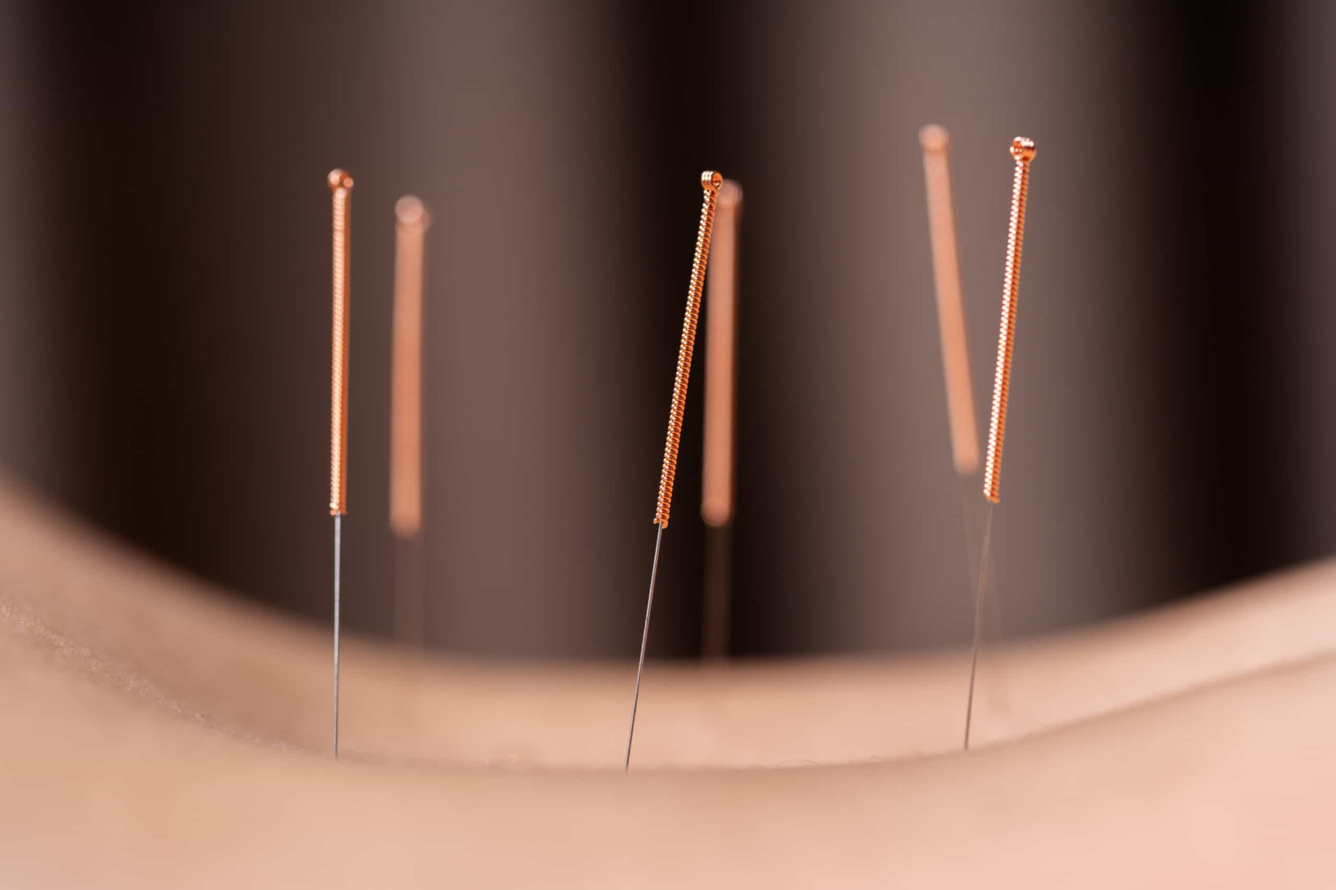 <p>You don't have to be in pain to get an acupuncture treatment. As a preventative medicine, acupuncture strengthens your immune system, promotes healthy circulation, and aids in organ and cell detoxification. It also alleviates pain and inflammation.</p><p>You may also like:<a href="https://www.starsinsider.com/n/456082?utm_source=msn.com&utm_medium=display&utm_campaign=referral_description&utm_content=509810en-us"> The most dangerous documentaries ever made</a></p>