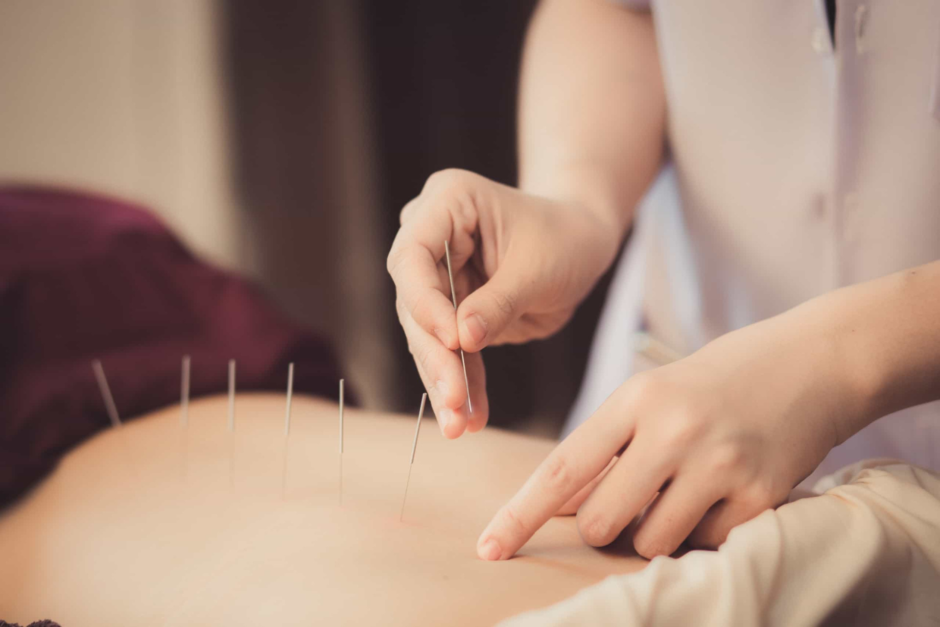 <p>Whether you have an ailment or feel well, acupuncture can help relieve pain or assist you in maintaining wellness. It also boosts immunity and helps you manage stress. However, if you have a bleeding disorder (like hemophilia), use blood thinners, or have any skin disease, then it should be avoided. If pregnant, then needling the abdominal area isn't advised.</p><p><a href="https://www.msn.com/en-us/community/channel/vid-7xx8mnucu55yw63we9va2gwr7uihbxwc68fxqp25x6tg4ftibpra?cvid=94631541bc0f4f89bfd59158d696ad7e">Follow us and access great exclusive content every day</a></p>