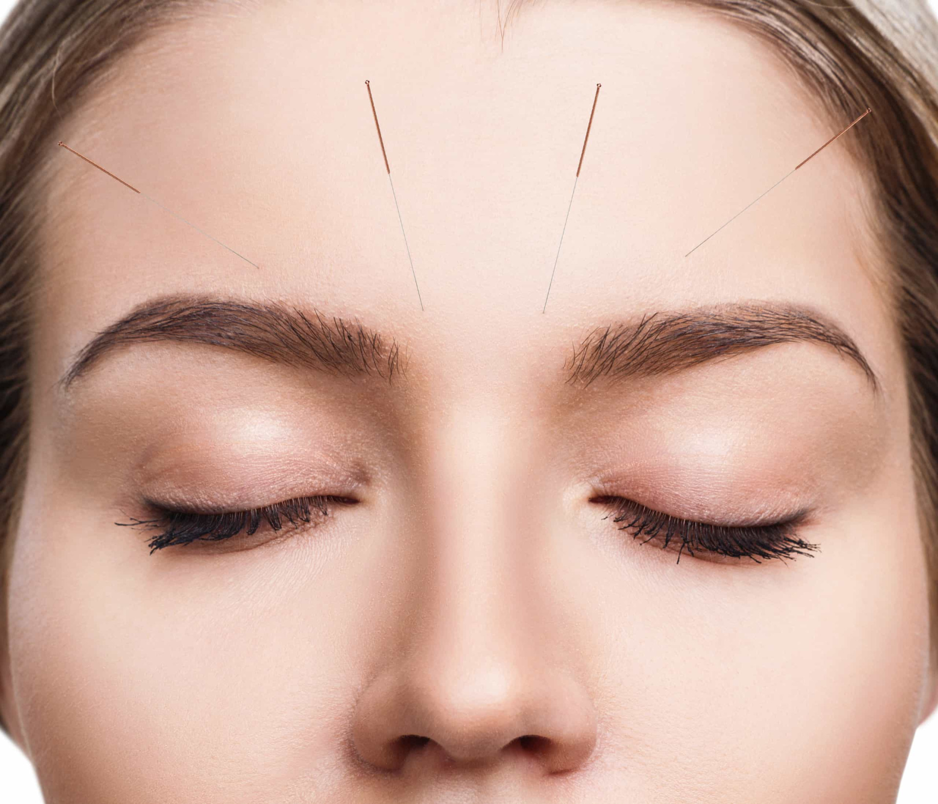 <p>You may think that you have to lay flat for hours during a session. However, the average acupuncture session typically takes just 15 to 20 minutes. The benefits can often be felt immediately.</p><p><a href="https://www.msn.com/en-us/community/channel/vid-7xx8mnucu55yw63we9va2gwr7uihbxwc68fxqp25x6tg4ftibpra?cvid=94631541bc0f4f89bfd59158d696ad7e">Follow us and access great exclusive content every day</a></p>