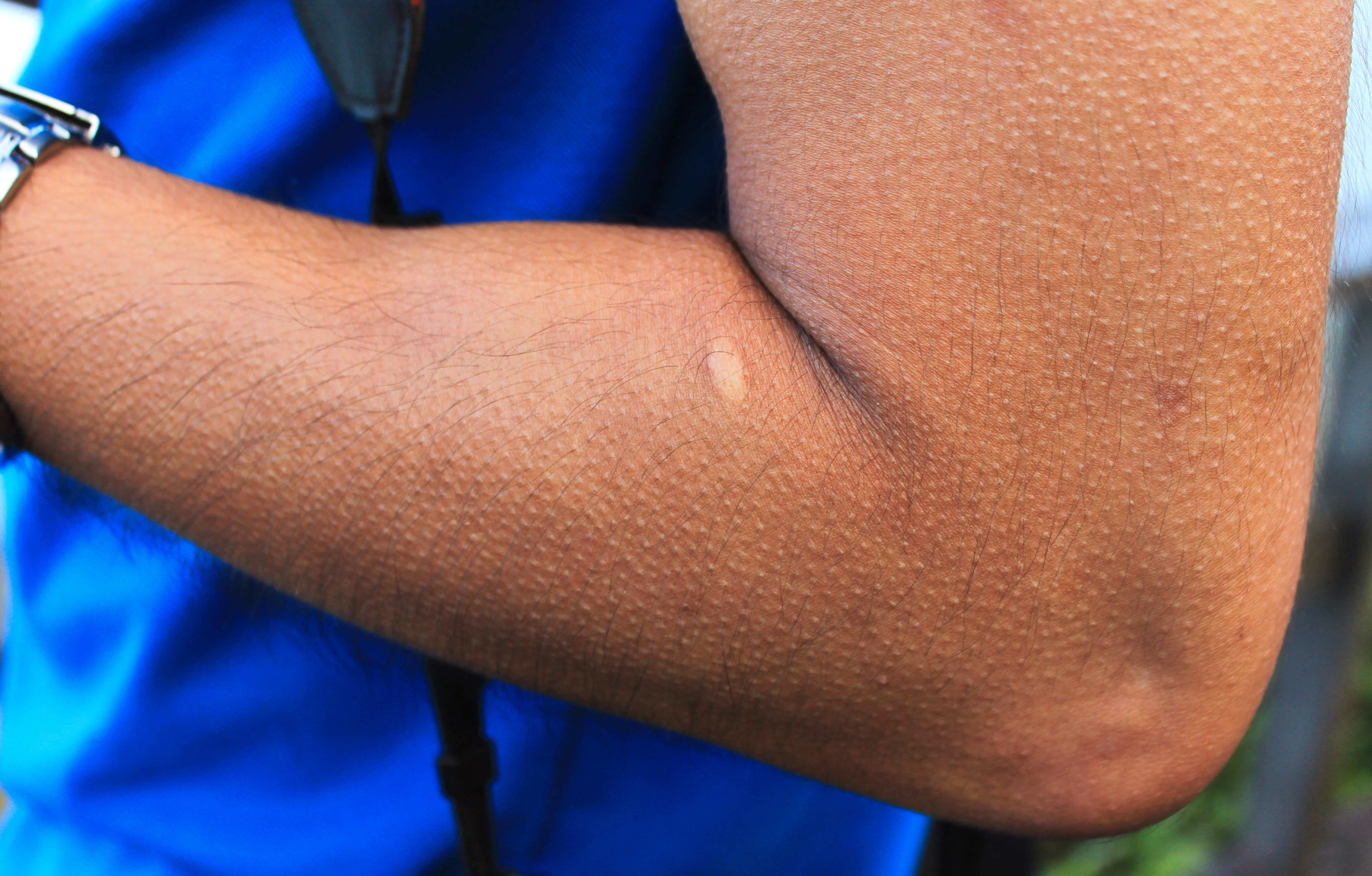 Why does our body have reactions that we cannot control?