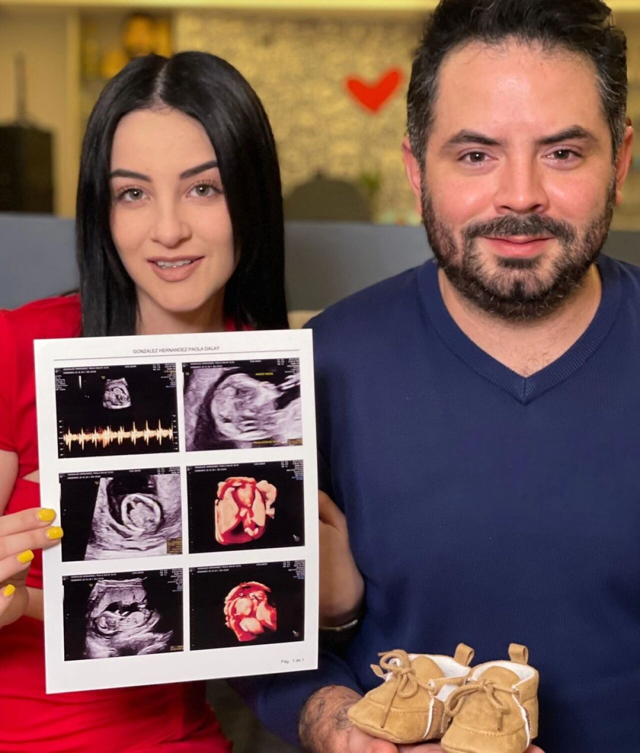 josé eduardo derbez y su novia revelan los nombres que han pensado para su bebé