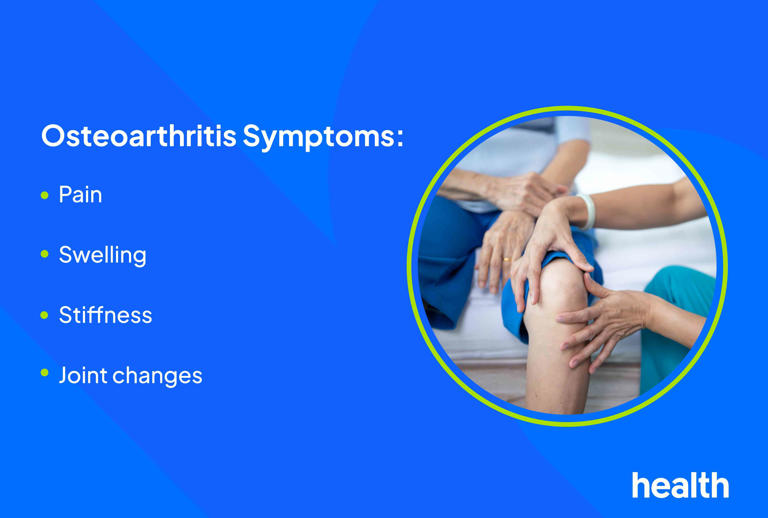 Signs and Symptoms of Osteoarthritis