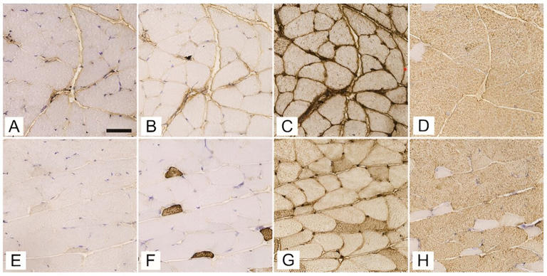 Expression of myosin heavy chain isoforms 1 (A, E), 2a (B, F), 2x/d (C, G), and 2b (D, H) in successive cross-sections of gluteus maximusmuscle of streptozotocin-induced diabetic mice (A–D) and age-matched non-diabetic mice (E–H). The scale bar indicates 50 μm. Credit: Biomolecules and Biomedicine (2023). DOI: 10.17305/bb.2023.9843