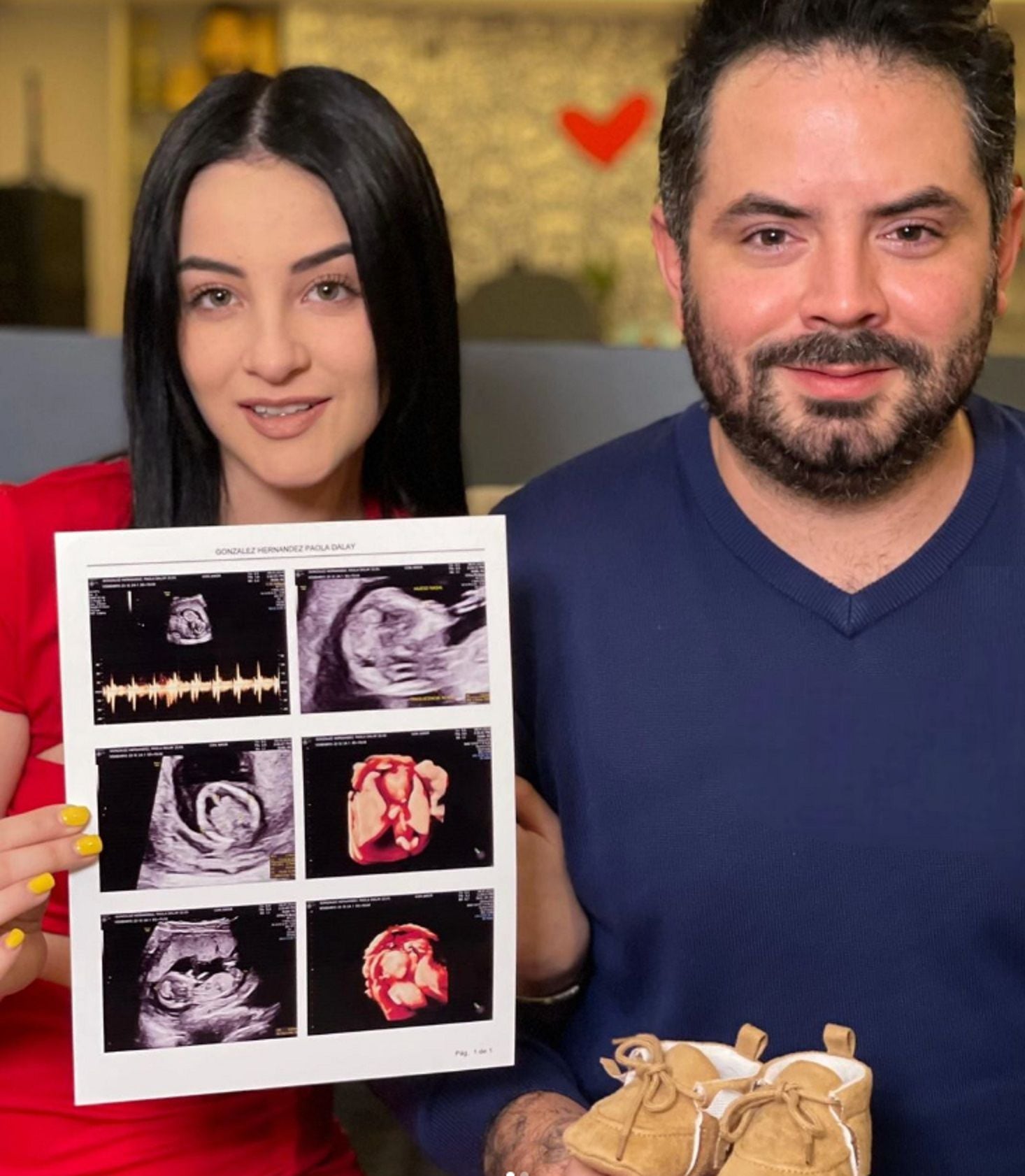 josé eduardo derbez y paola dalay narran cómo recibieron la noticia de su embarazo