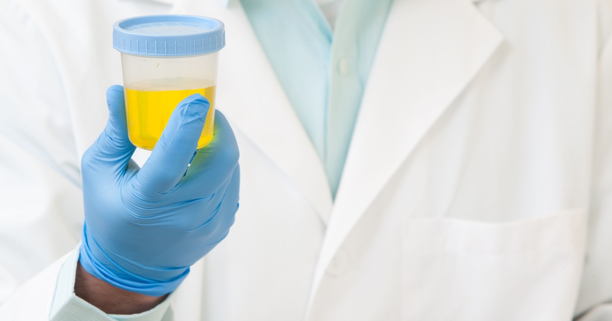 forskargenombrott: urin banar väg för hållbar batteriåtervinning