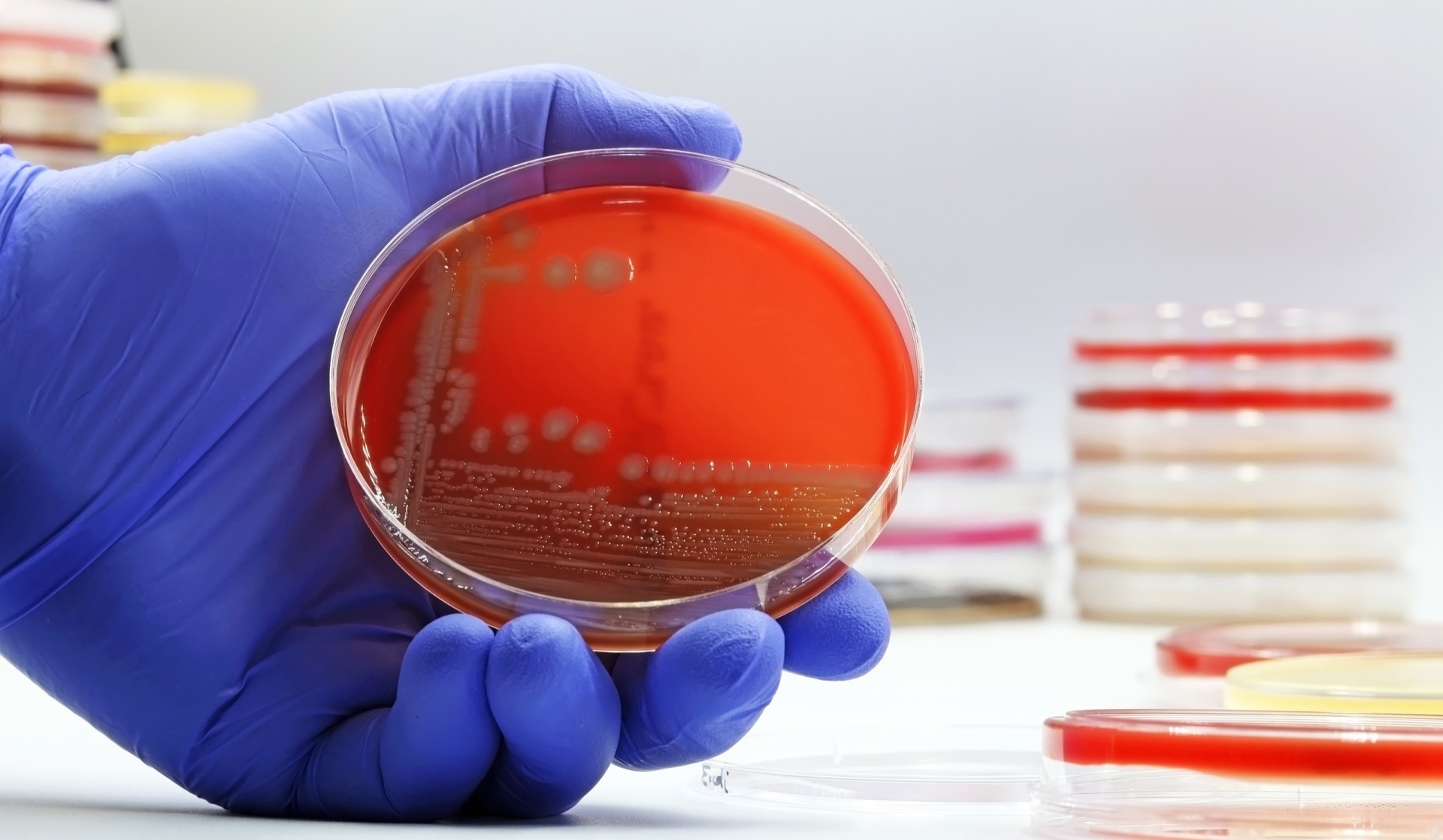 Understanding E. coli: Everything you need to know about this serious ...