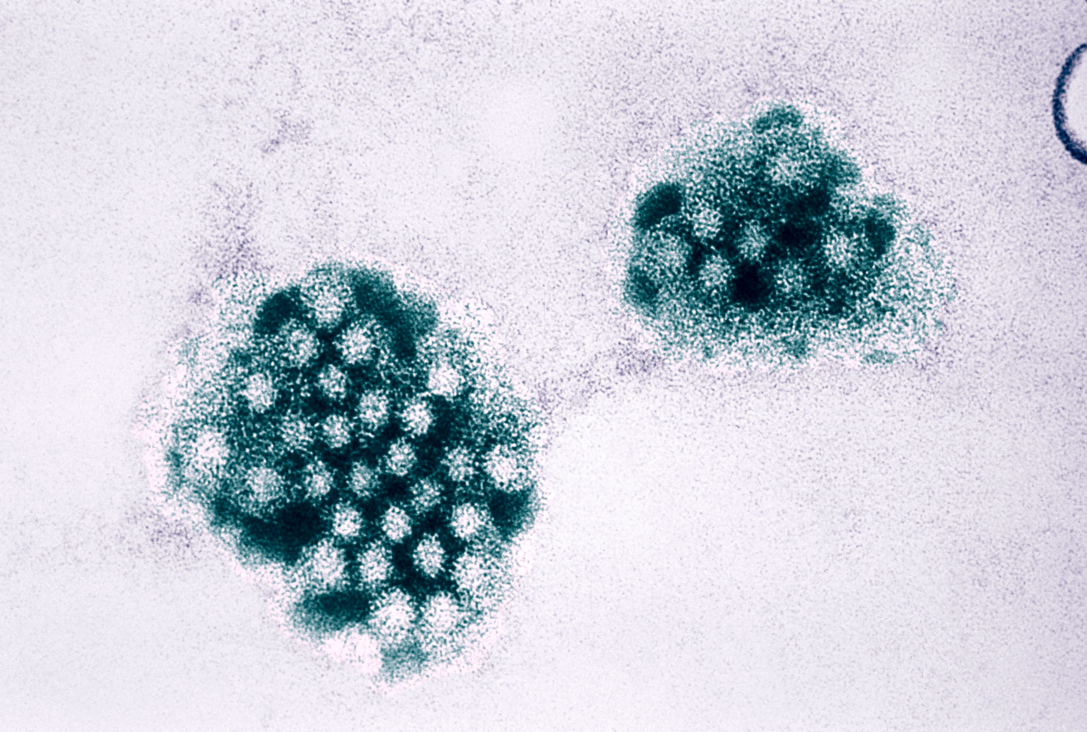 stomach virus spreading in northeast at highest rate in us: cdc