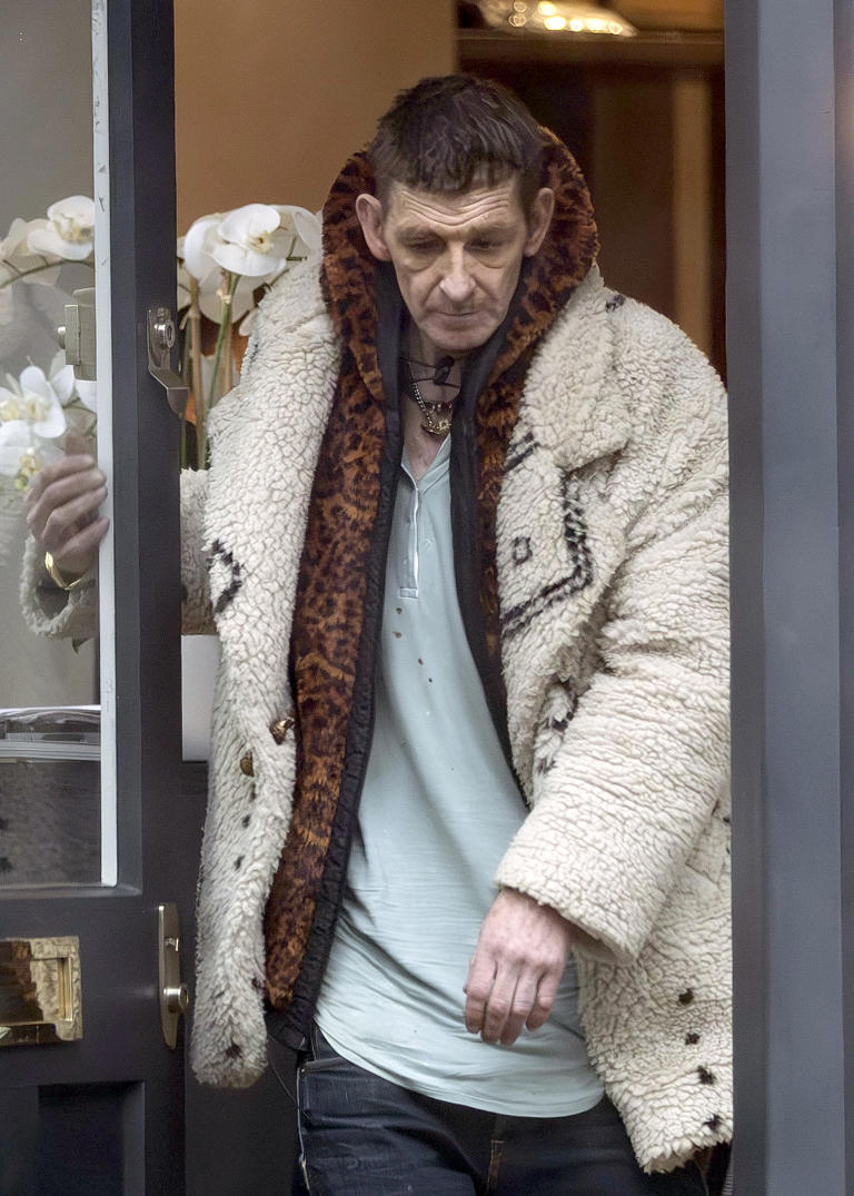 Disheveled ‘peaky Blinders Star Paul Anderson Looks Unrecognizable In New Photos 