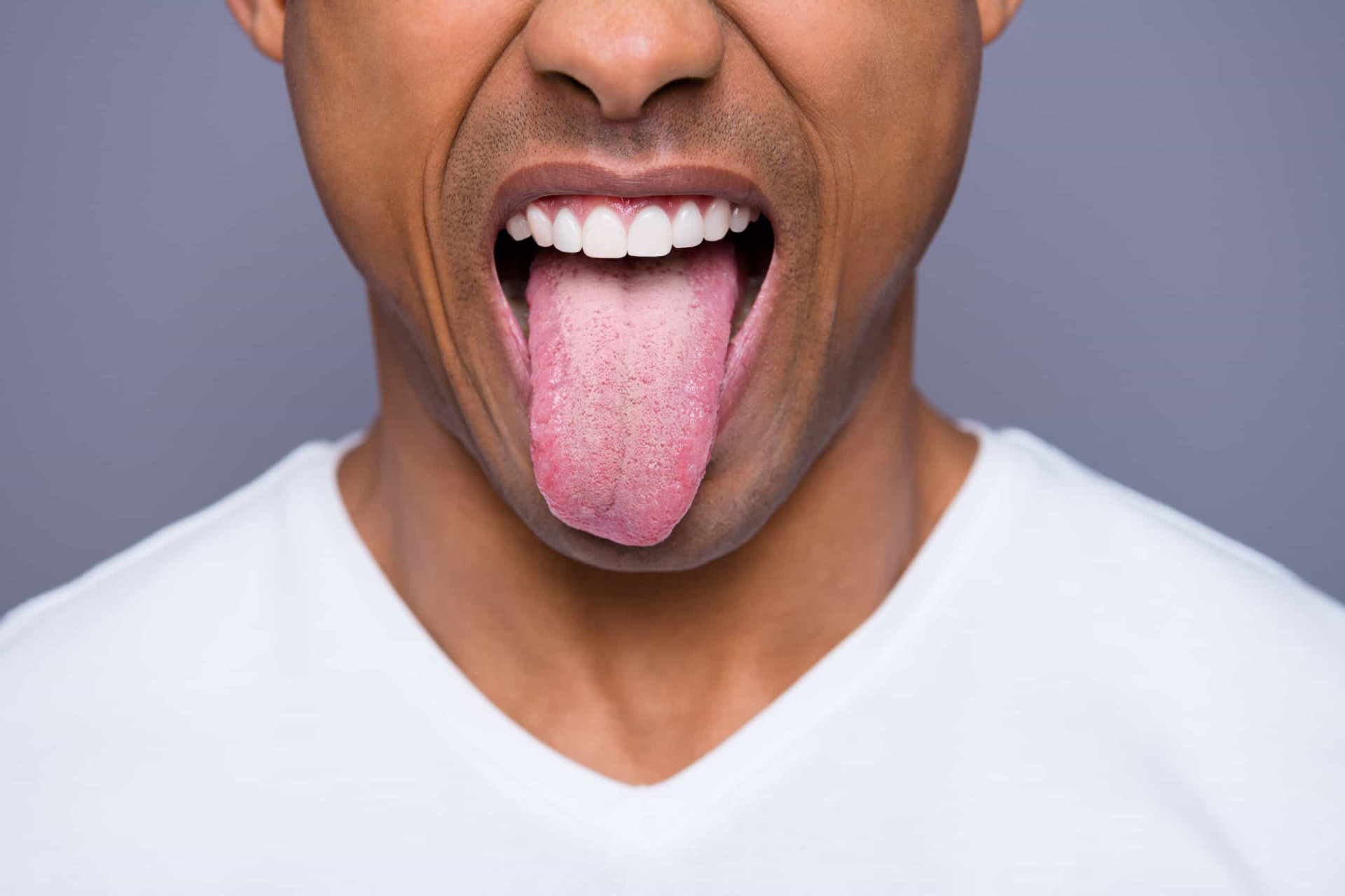 signs-you-have-iron-deficiency