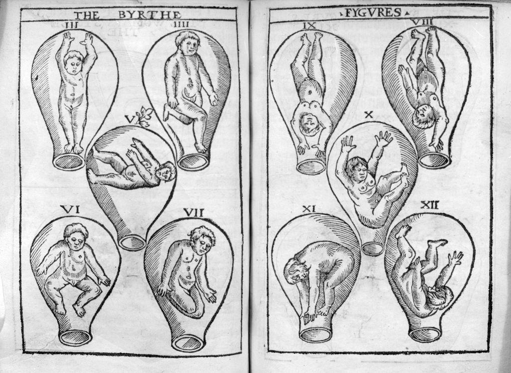 la teoría del “útero errante” de los antiguos griegos que dio origen al concepto de histeria