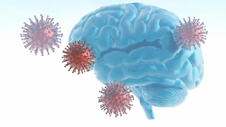 Gehirnnebel: Forscher haben Ursache dieser Corona-Langzeitfolge gefunden