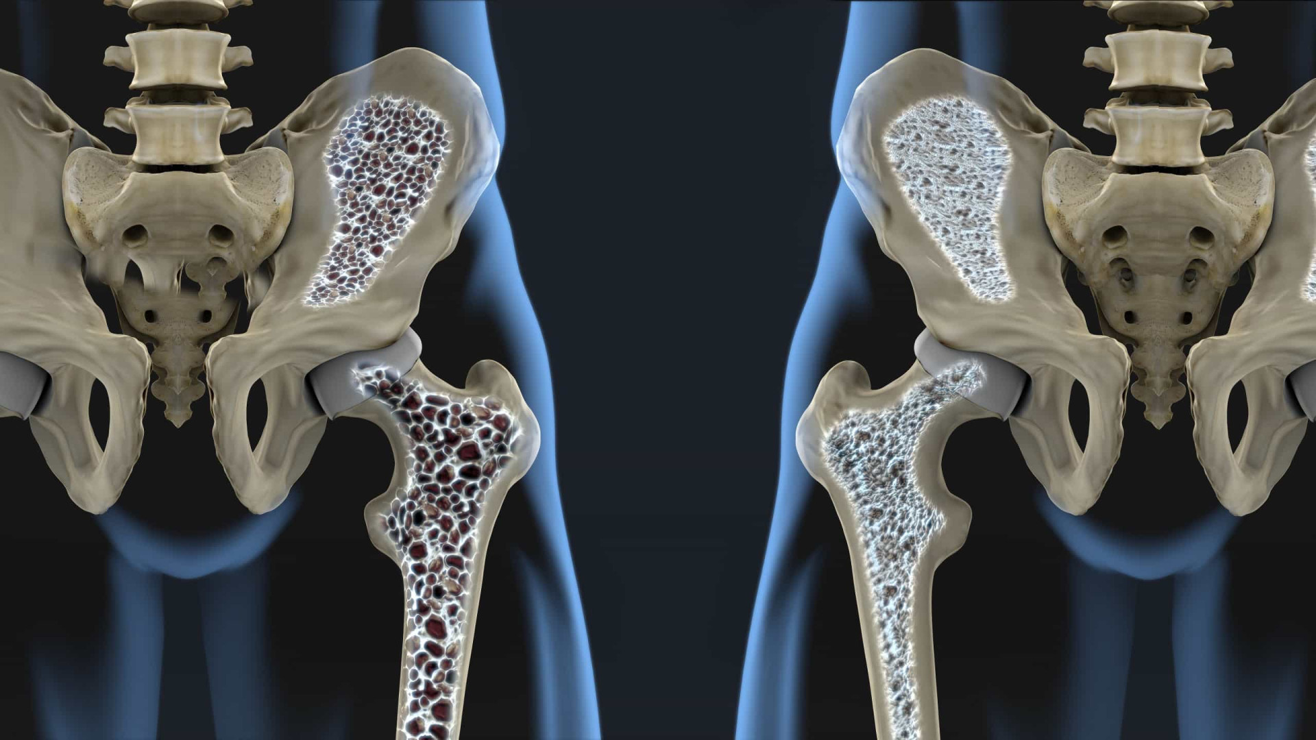 <p><span>This will help you avoid conditions such as <a href="https://www.starsinsider.com/lifestyle/187513/osteoporosis-the-silent-disease" rel="noopener">osteoporosis</a> and osteopenia, which are linked to low bone density. </span></p><p>You may also like:<a href="https://www.starsinsider.com/n/119097?utm_source=msn.com&utm_medium=display&utm_campaign=referral_description&utm_content=434051v2en-en"> Harmful to health: the hidden hazards of food and drink </a></p>