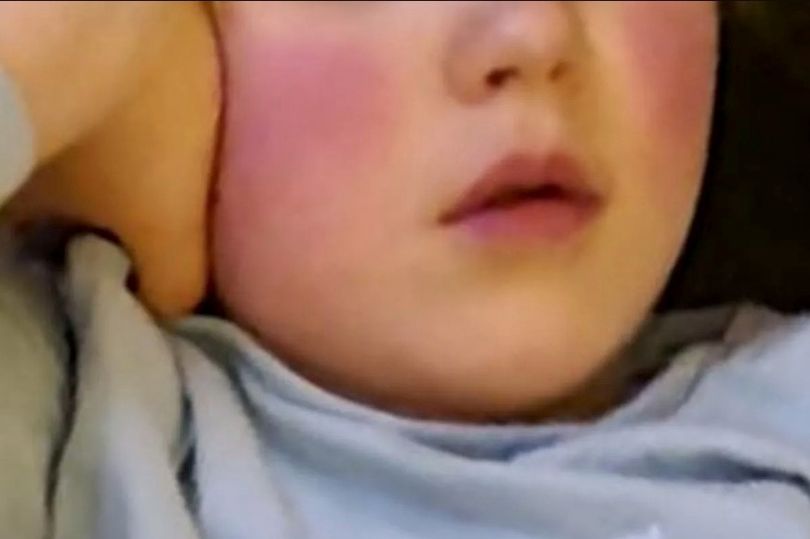 doctors told mum her daughter's symptoms were scarlet fever - but she knew something was off