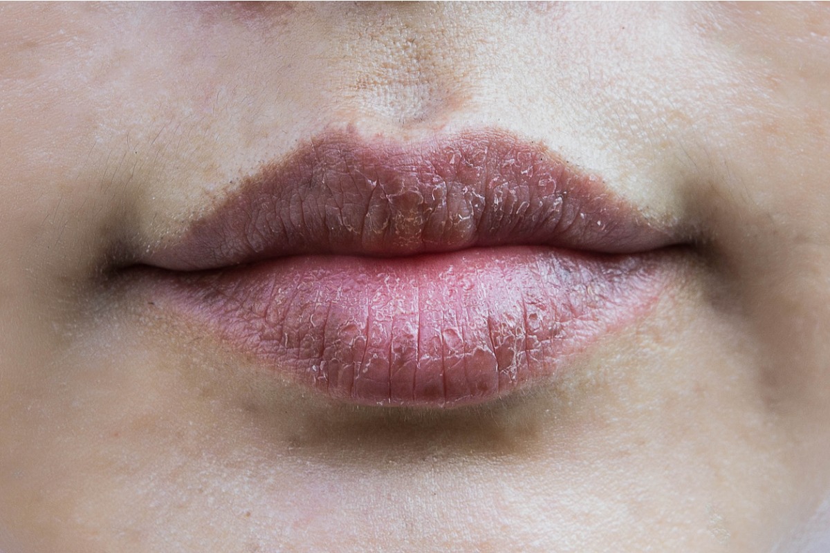 color natural de tus labios reflejan mucho sobre tu salud: 3 señales de alerta