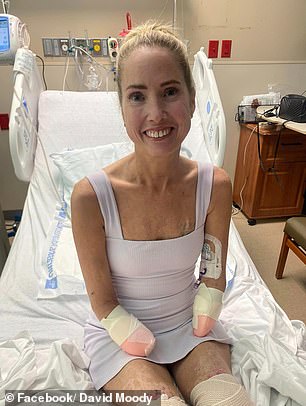 teacher, 51, has her feet and hands amputated after a sore throat led to sepsis: 'her limbs were black and mummified'
