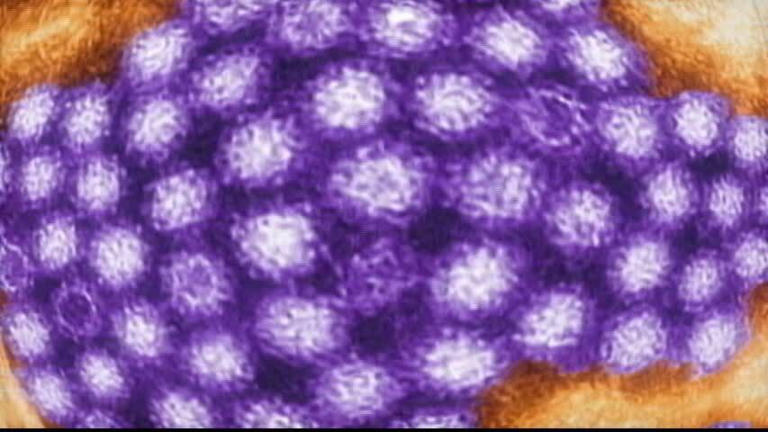 norovirus-outbreaks-reported-in-connecticut-as-spring-approaches