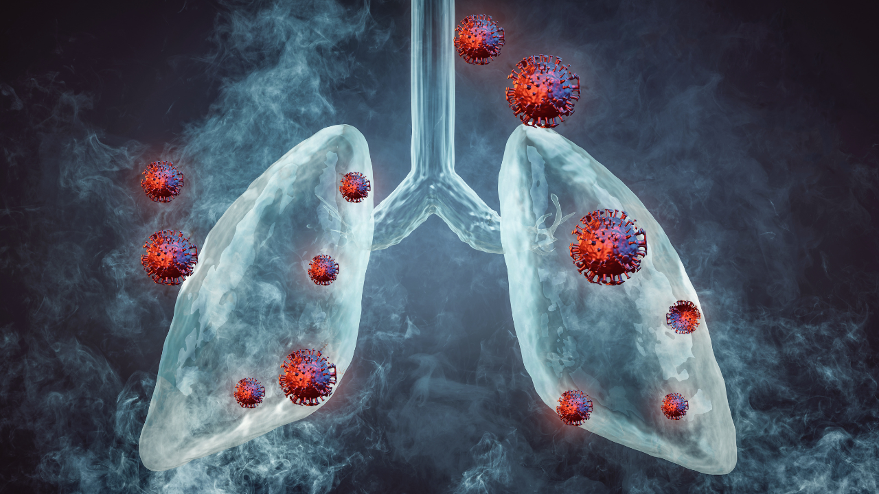 lung cancer in non-smokers: exploring causes and risk factors