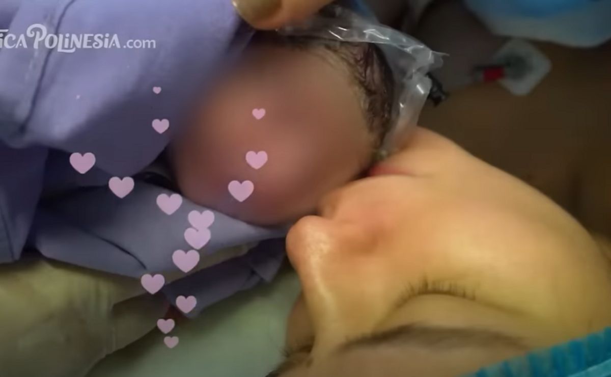 cómo se llama la bebé de lesslie polinesia y por qué está hospitalizada