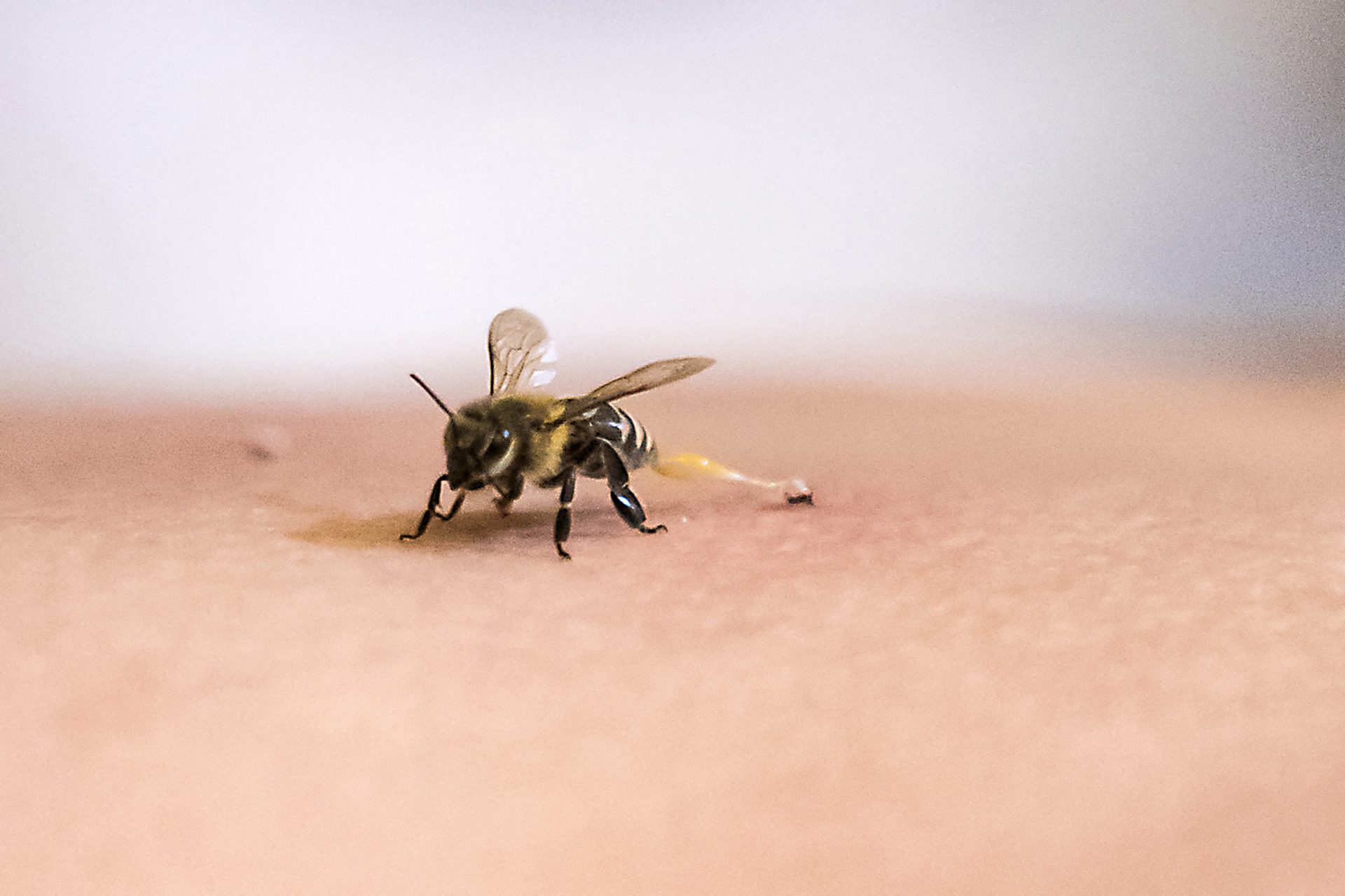 how-to-treat-insect-and-animal-bites