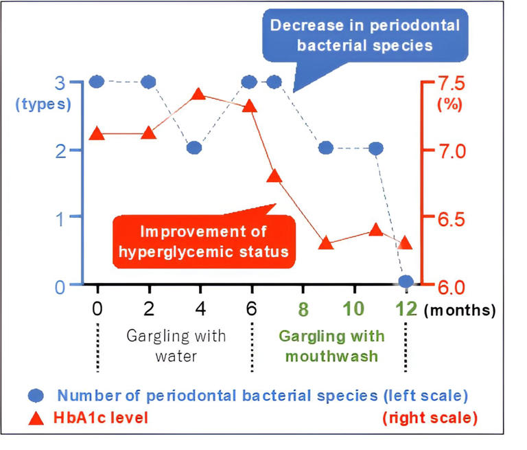 Gargling Away The 'bad' Bacteria In Type 2 Diabetes