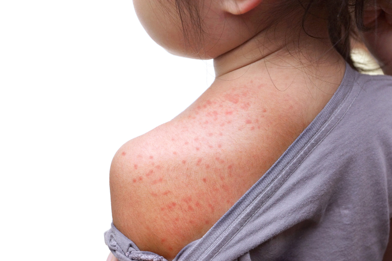 three suspected and one confirmed case of measles reported in latest weekly figures