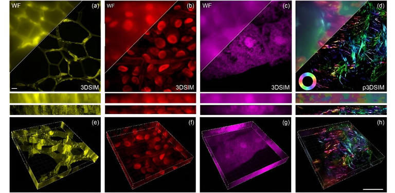 Super-resolution microscopy harnesses digital display technology