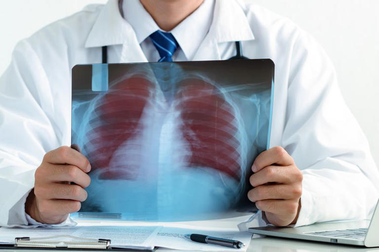 Surge in lung cancer cases in middle-aged non-smokers 'down to ...