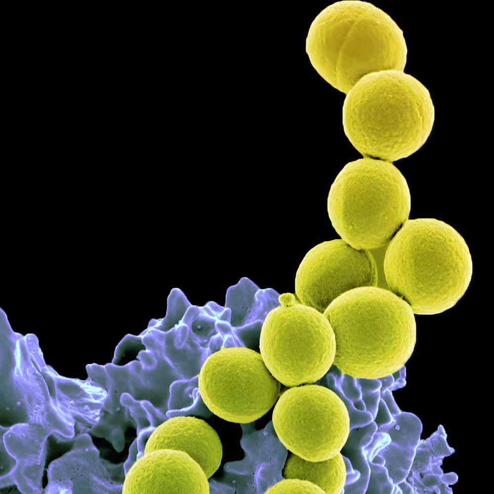 gegen unbehandelbare infektionen: neue methode verspricht bessere antibiotika