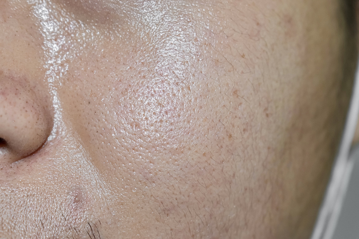 rutina facial para el cuidado de la piel en hombres: olvídate de las barbas enquistadas