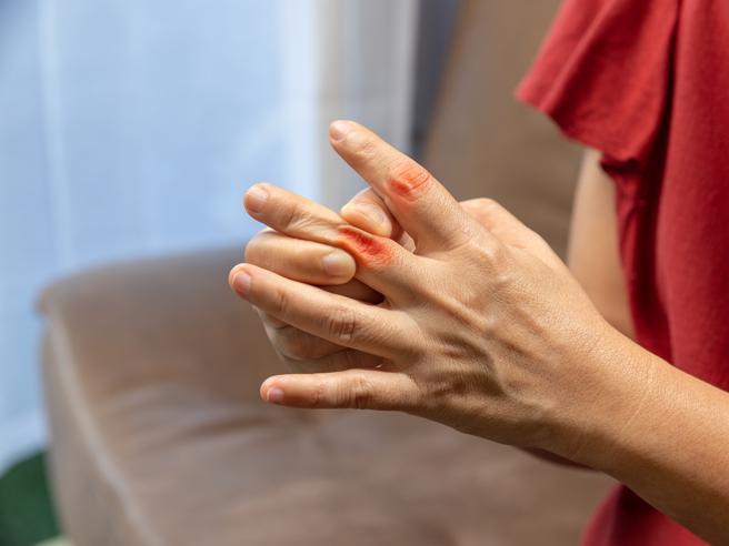 artrite reumatoide, quanto contano gli ormoni femminili e quanto le abitudini poco salutari