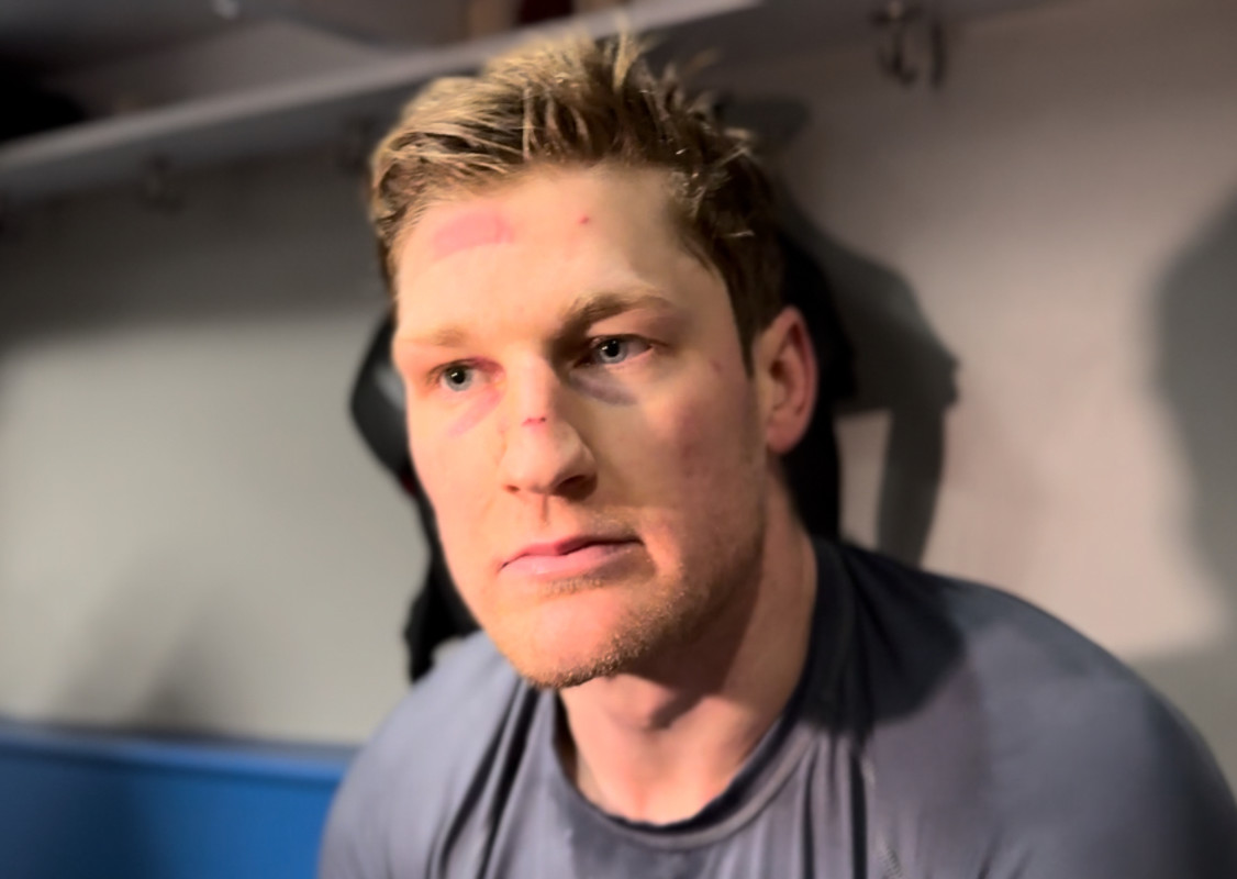 Nathan MacKinnon Suffered Broken Nose Against Lightning