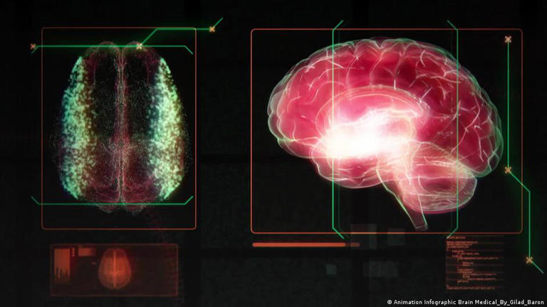 Representación del cerebro