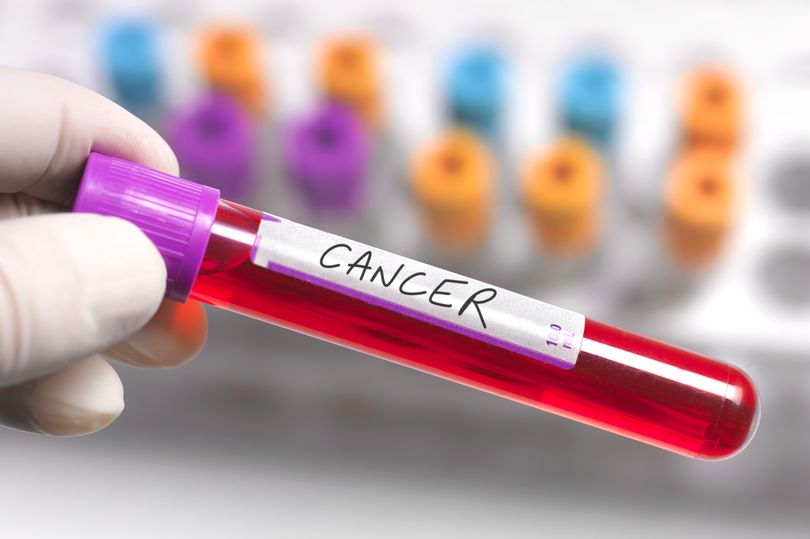 Cancer Screening As 175,000 At Higher Risk And Most Don't Know