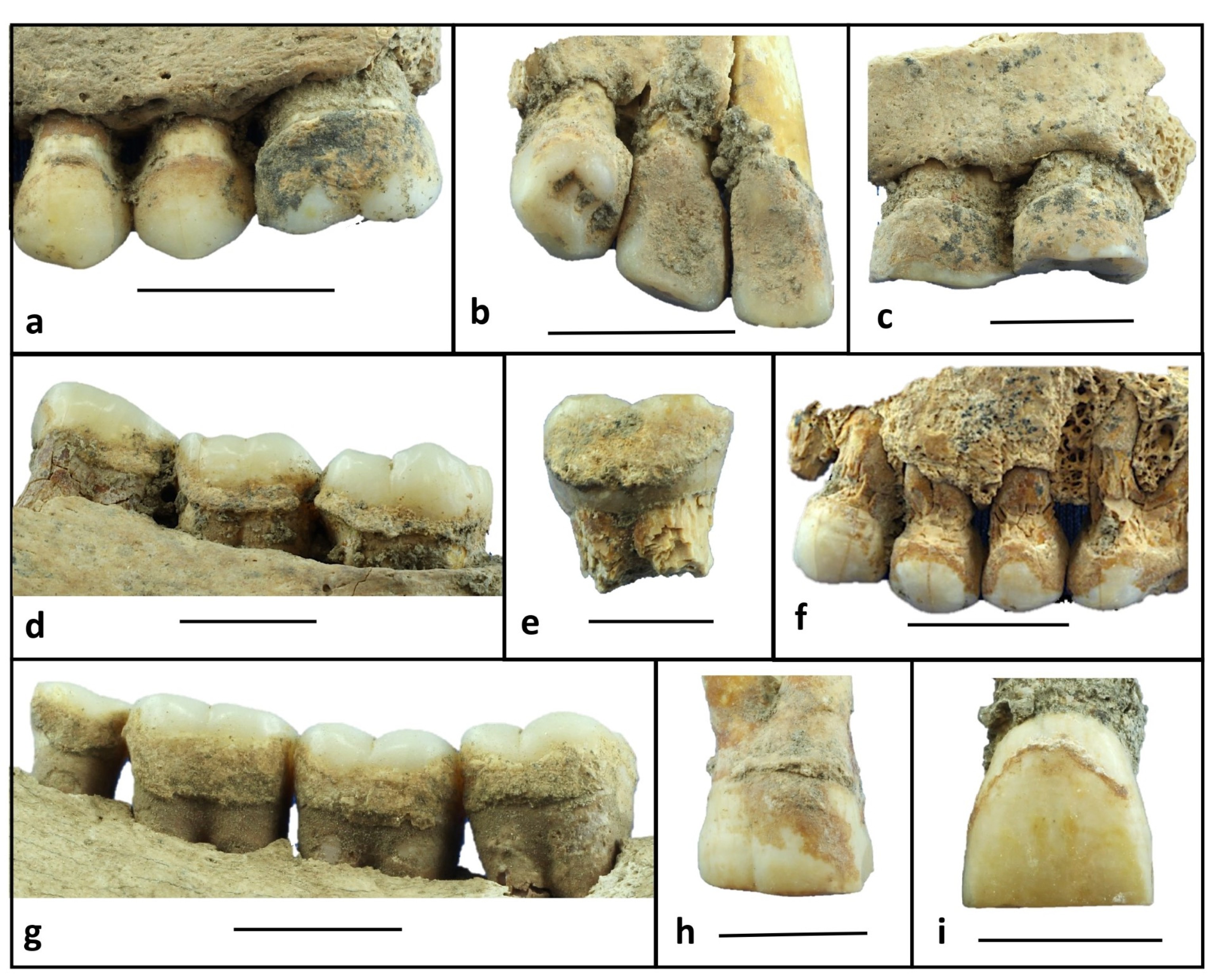 il tartaro dentale di 6.000 anni fa rivela la dieta neolitica
