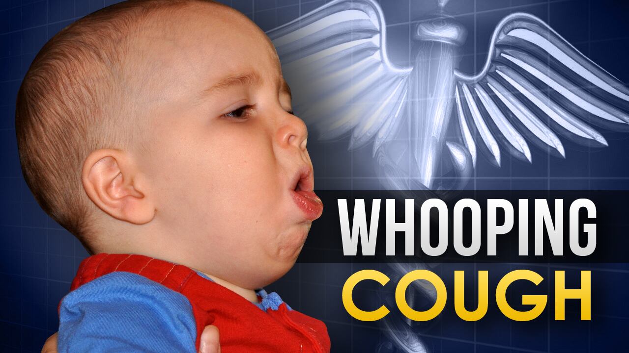 Whooping Cough Cases Continue To Rise In Cass County