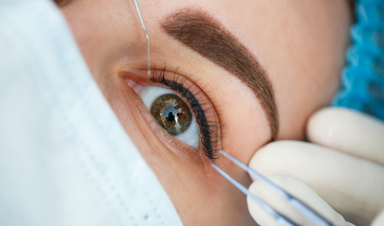 ¿qué es la queratopigmentación? la peligrosa operación cosmética podría dejarte sin visión