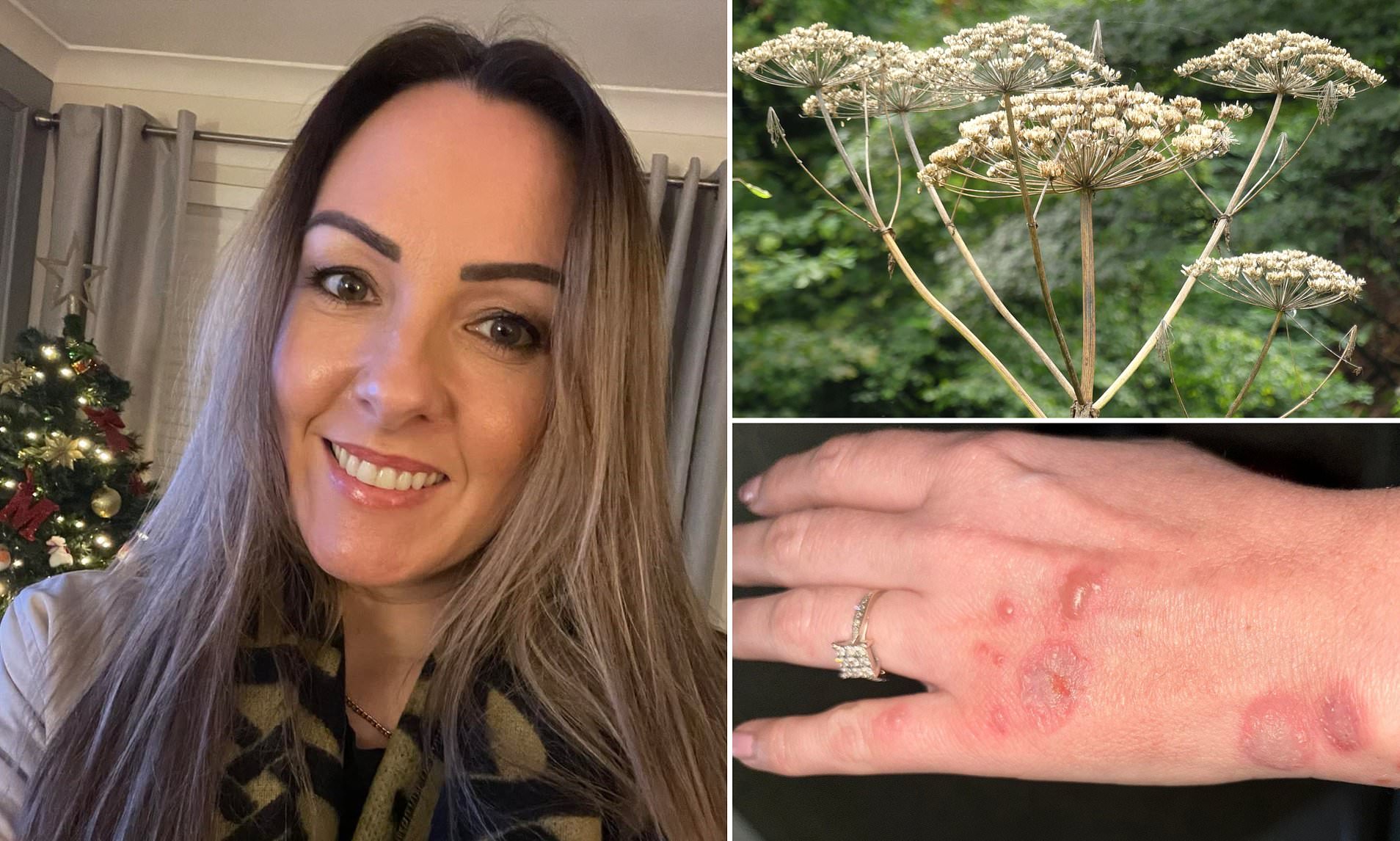 Britain's 'most Dangerous Plant' Strikes In Paisley: Woman Is Left With ...