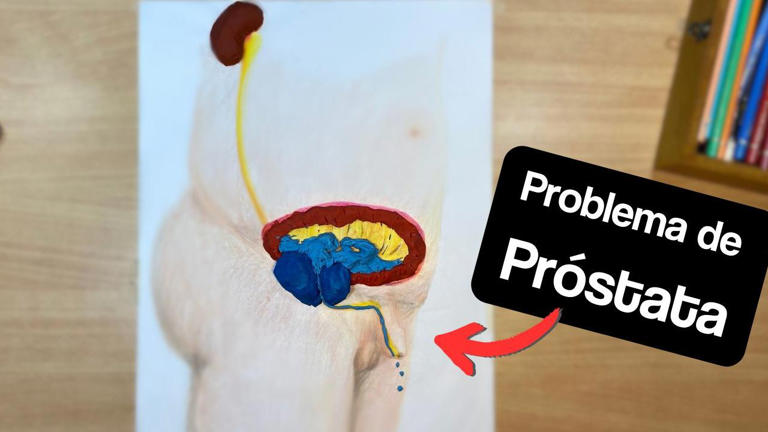 Atención Hombres: Conozca las 3 enfermedades que afectan la Próstata