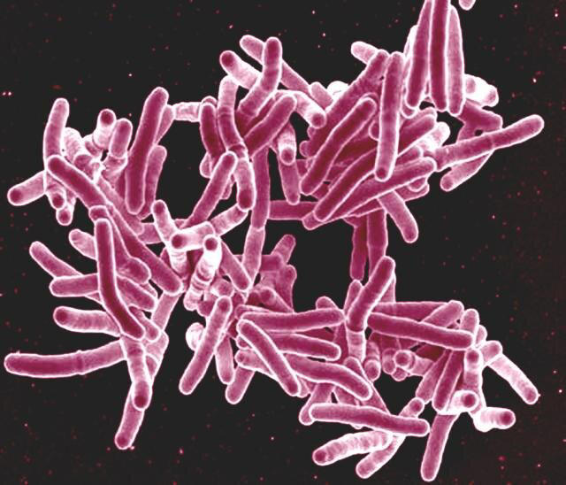Scanning electron micrograph of Mycobacterium tuberculosis bacteria, which cause TB. Credit: NIAID