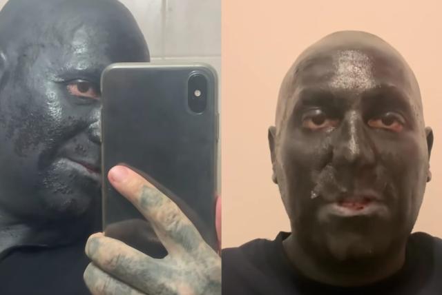 repudio por hombre que se tatuó la cara y la cabeza de negro y dice que lo discriminan