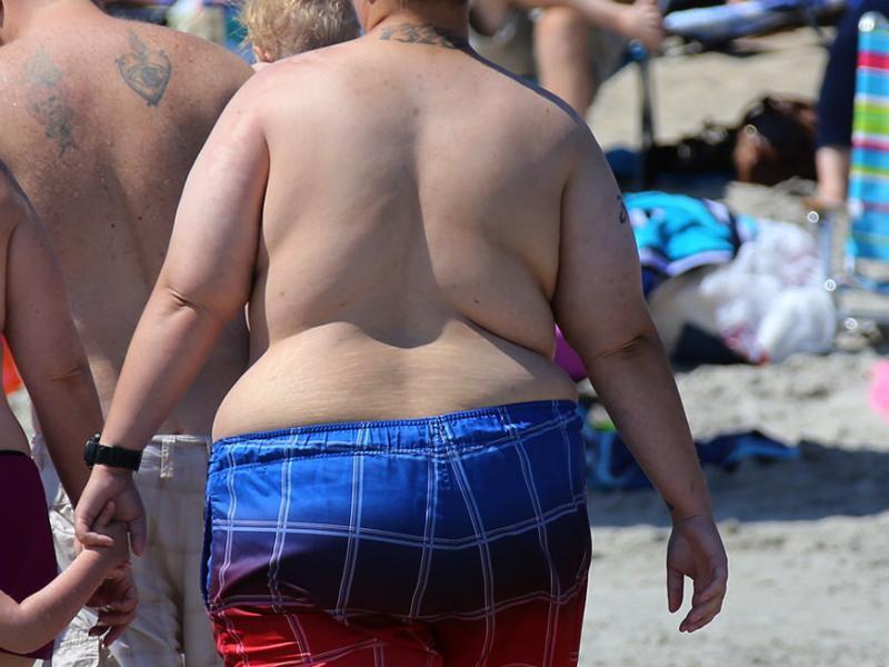 více než miliarda lidí je obézních, nejhorší situace je v ostrovních zemích