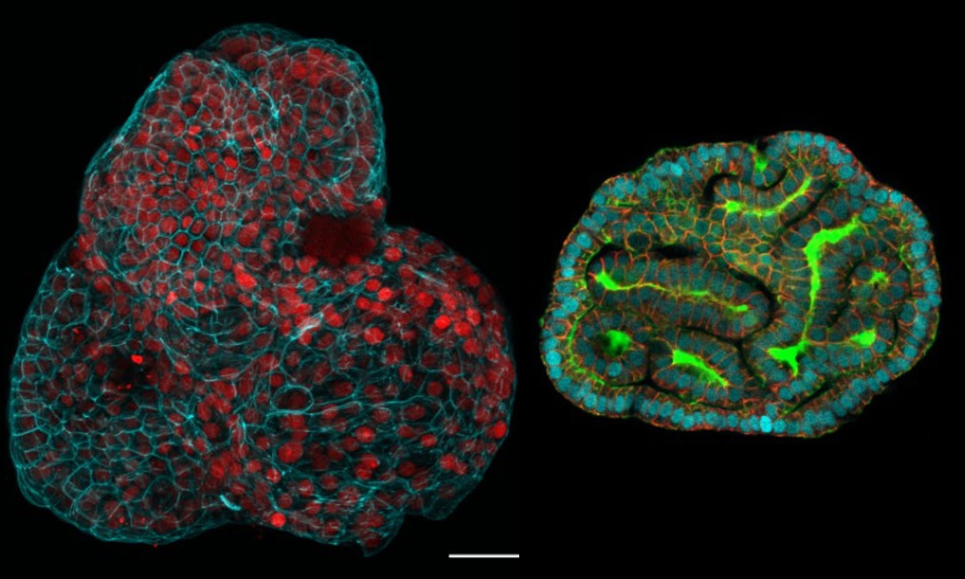 'Mini Organs' Are Grown From Human Stem Cells Taken During The Late ...