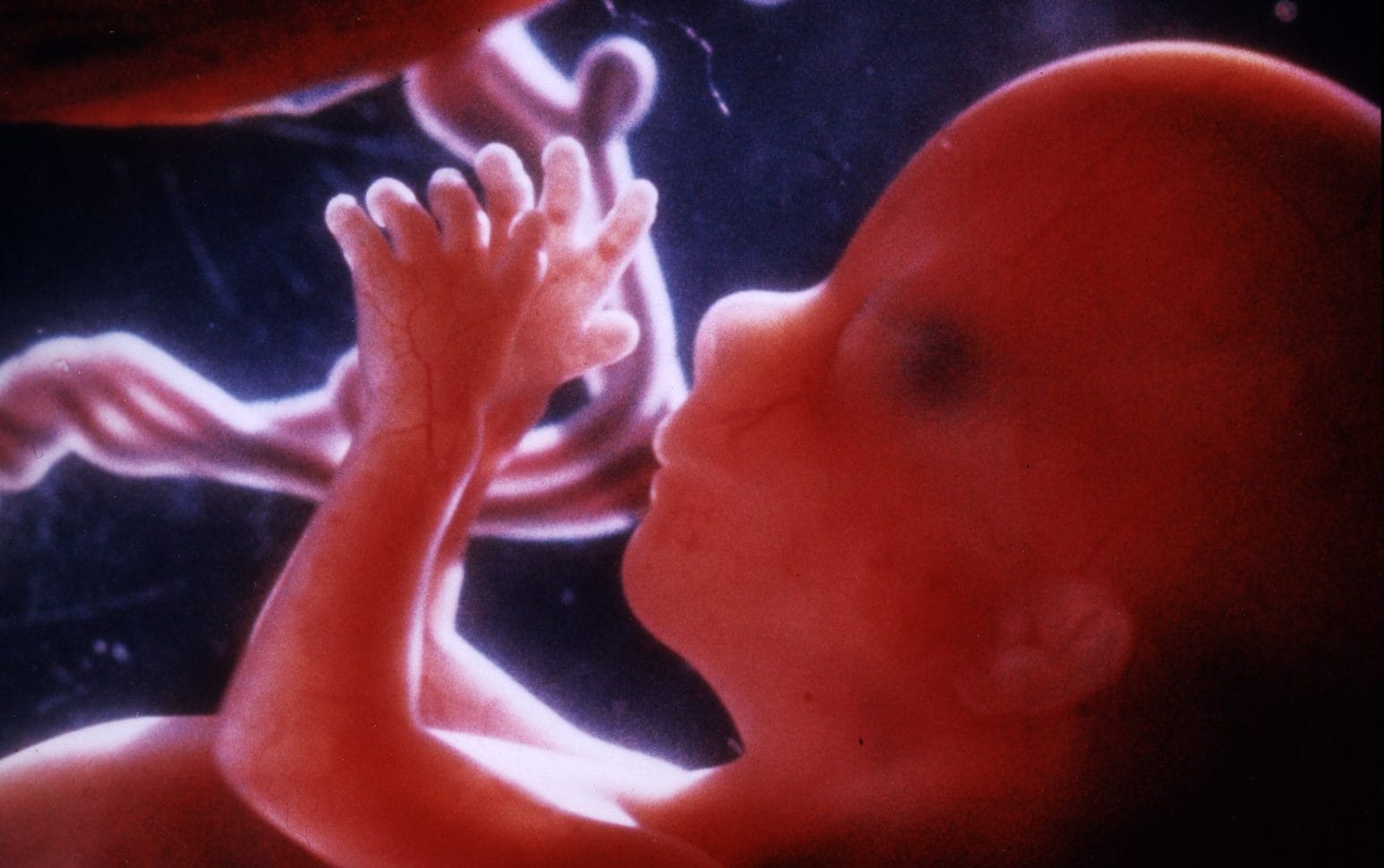 tiny organs grown from amniotic fluid could spot problems before birth