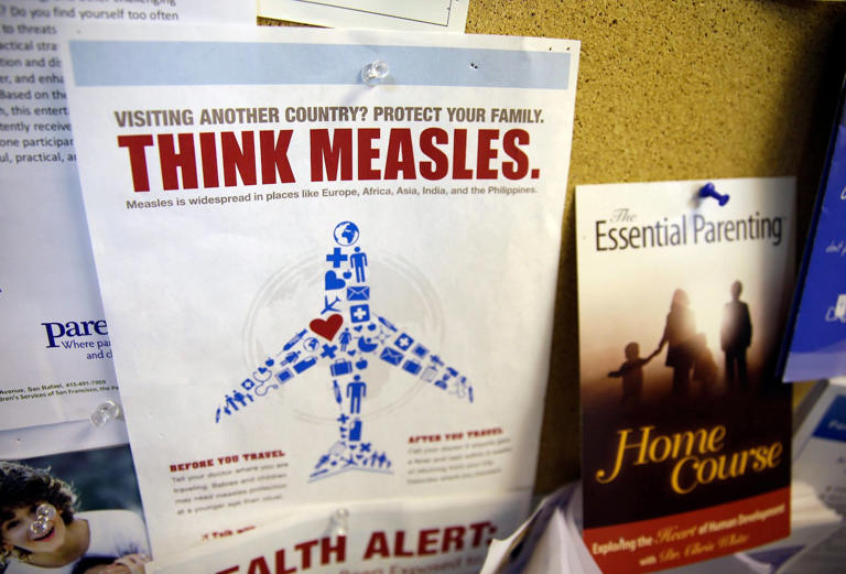 A flyer educating parents about measles on a medical clinic bulletin board. Ottawa Public Health said Monday there are no reported or suspected cases of the disease in the city.