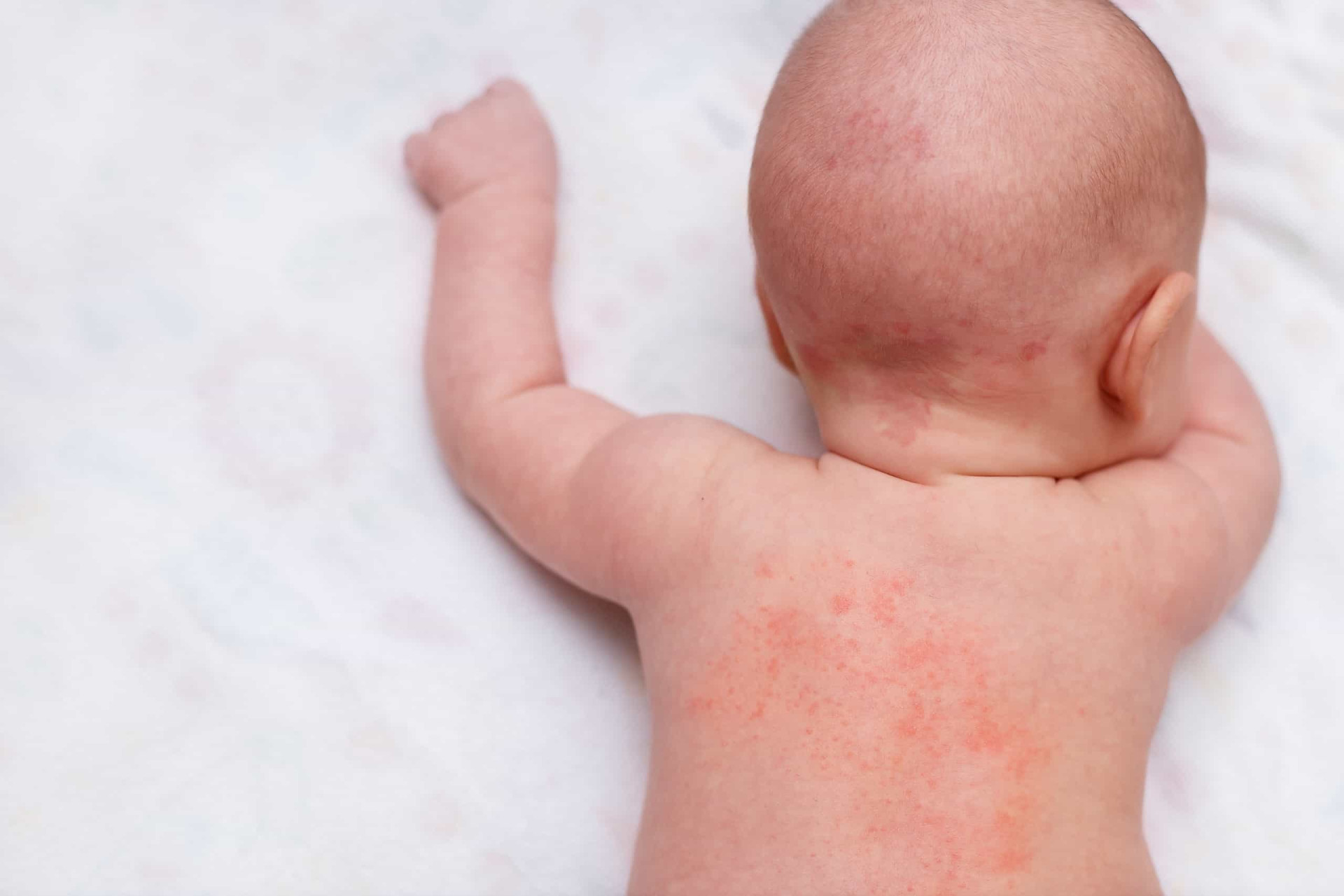 See a doctor if your kids have these symptoms