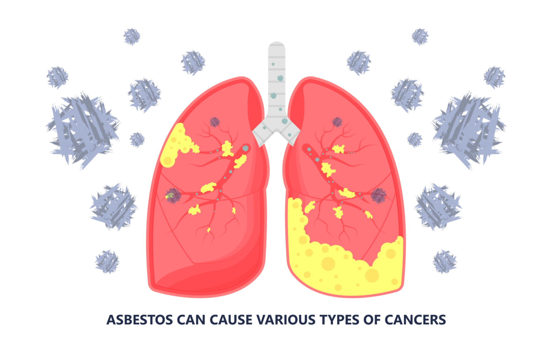 Why is asbestos so dangerous?