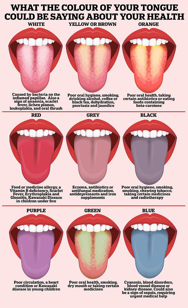 Open wide! What the COLOUR of your tongue could be saying about your health