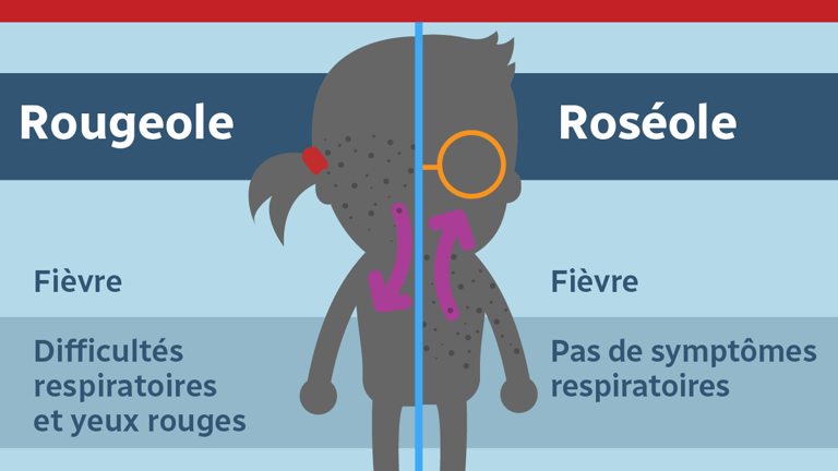 Votre enfant a-t-il la rougeole ou la roséole? Savez-vous les distinguer?