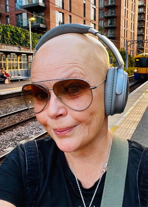 gail porter opens up about how hair loss left her homeless and sleeping on a park bench